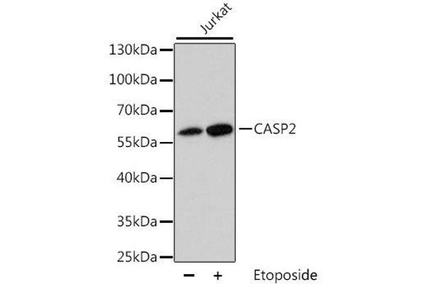 Caspase 2 抗体  (AA 153-452)