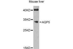 Western blot analysis of extracts of mouse liver, using AQP5 Antibody (ABIN6003635) at 1/1000 dilution. (Aquaporin 5 抗体)