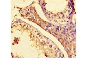 Immunohistochemistry of paraffin-embedded human testis tissue using ABIN7155509 at dilution of 1:100 (SETD1A 抗体  (AA 188-304))