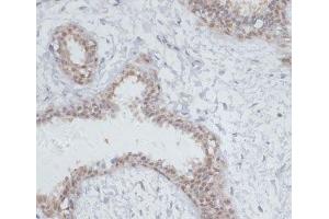Immunohistochemistry of paraffin-embedded Human breast using NOL3 Polyclonal Antibody at dilution of 1:100 (40x lens). (NOL3 抗体)