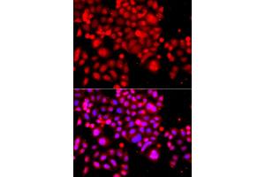 Immunofluorescence analysis of A549 cells using ASCC3 antibody.