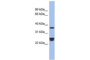 OAZ2 antibody used at 1 ug/ml to detect target protein.