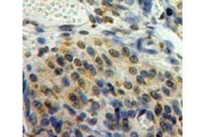 Used in DAB staining on fromalin fixed paraffin-embedded ovary tissue (EGR2 抗体  (AA 147-403))