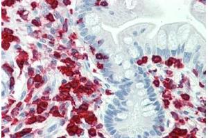 Human Small Intestine: Formalin-Fixed, Paraffin-Embedded (FFPE) (PON2 抗体  (AA 79-107))