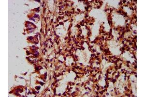 IHC image of ABIN7165873 diluted at 1:400 and staining in paraffin-embedded human lung tissue performed on a Leica BondTM system. (NLRC5 抗体  (AA 95-208))