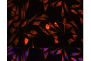 Immunofluorescence analysis of L929 cells using PTCD1 Polyclonal Antibody at dilution of 1:100. (PTCD1 抗体)