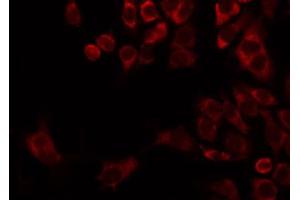 ABIN6274736 staining HepG2 by IF/ICC. (MRPL22 抗体  (Internal Region))