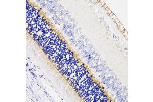 Immunohistochemistry of paraffin-embedded rat retina using  antibody (ABIN6129704, ABIN6136903, ABIN6136905 and ABIN6216979) at dilution of 1:200 (40x lens). (Anoctamin 2 抗体  (AA 1-200))