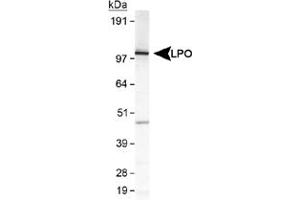 Western blot analysis of LPO in MDA-MB-231 cell lysate using LPO polyclonal antibody . (LPO 抗体  (AA 650-712))