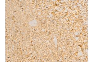 ABIN6267219 at 1/100 staining human glioma tissue sections by IHC-P.