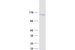 LRFN5 Protein (Myc-DYKDDDDK Tag)
