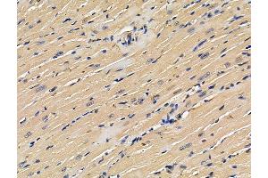 ABIN7096260 and ABIN7100322 at 1/100 staining mouse heart tissue by IHC-P. (Ubiquinol-Cytochrome C Reductase Complex Chaperone (UQCC) 抗体)