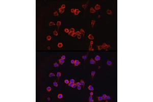 Immunofluorescence analysis of Jurkat cells using NF Rabbit pAb (ABIN3022100, ABIN3022101, ABIN3022102 and ABIN6218604) at dilution of 1:100 (40x lens). (NFATC1 抗体  (AA 20-300))