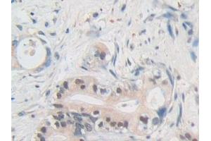 Immunohistochemistry (IHC) image for anti-Nucleoporin 50kDa (NUP50) (AA 37-269) antibody (ABIN7442900)