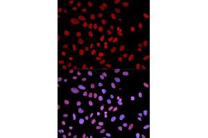 Immunofluorescence analysis of U2OS cell using PTPN6 antibody. (SHP1 抗体)