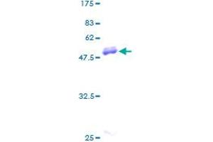 CD58 Protein (CD58) (AA 1-240) (GST tag)