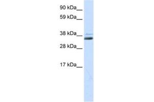Western Blotting (WB) image for anti-Secreted Frizzled-Related Protein 1 (SFRP1) antibody (ABIN2463723) (SFRP1 抗体)