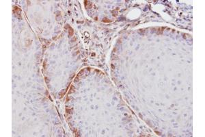 IHC-P Image Immunohistochemical analysis of paraffin-embedded Cal27 xenograft, using ASS1, antibody at 1:100 dilution. (ASS1 抗体)