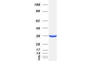 Western Blotting (WB) image for Pleckstrin Homology Domain Containing Family A3 (PLEKHA3) protein (Myc-DYKDDDDK Tag) (ABIN2729162)