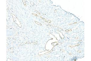 Immunohistochemistry (IHC) image for anti-Cadherin 5 (CDH5) (AA 25-595) antibody (ABIN7453992)