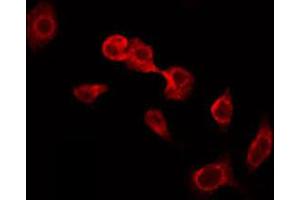ABIN6274914 staining HeLa by IF/ICC. (Glucuronidase beta 抗体  (Internal Region))