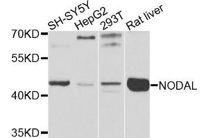 Western blot analysis of extracts of various cell lines, using NODAL antibody. (Nodal 抗体)