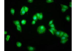 Immunofluorescence staining of HepG2 cells with ABIN7160260 at 1:100, counter-stained with DAPI. (ZFP36 抗体  (AA 16-103))