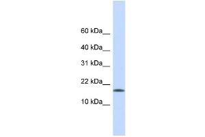 WB Suggested Anti-CENPA Antibody Titration:  0. (CENPA 抗体  (Middle Region))