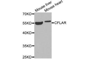 Western blot analysis of extracts of various tissues, using CFLAR antibody. (FLIP 抗体  (AA 161-480))