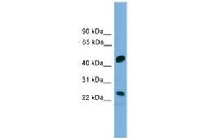 Image no. 1 for anti-Cell Division Cycle Associated 4 (CDCA4) (AA 143-192) antibody (ABIN6745604) (CDCA4 抗体  (AA 143-192))