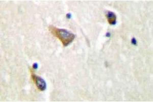 Immunohistochemistry (IHC) analyzes of Clusterin-alpha antibody in paraffin-embedded human brain tissue. (Clusterin 抗体)