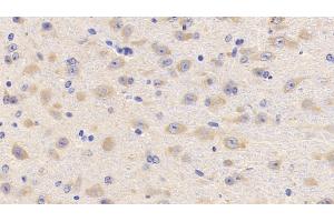 Detection of LCAT in Mouse Cerebrum Tissue using Polyclonal Antibody to Lecithin Cholesterol Acyltransferase (LCAT) (LCAT 抗体  (AA 41-210))