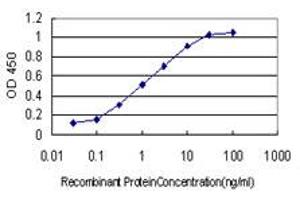 Detection limit for recombinant GST tagged LAMB3 is approximately 0. (Laminin beta 3 抗体  (AA 1064-1171))