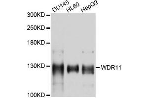 Western blot analysis of extracts of various cells, using WDR11 antibody. (WDR11 抗体)