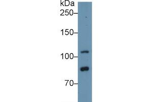 Western blot analysis of Human HeLa cell lysate, using Human TLR5 Antibody (1 µg/ml) and HRP-conjugated Goat Anti-Rabbit antibody ( (TLR5 抗体  (AA 693-858))