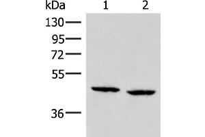 Western blot analysis of PC3 and Hela cell lysates using ZFYVE27 Polyclonal Antibody at dilution of 1:350 (ZFYVE27 抗体)
