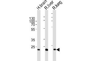 Western blot analysis of lysates from human brain , rat liver and lung tissue lysate (from left to right), using GSTT1 Antibody (N-term) (ABIN6244315 and ABIN6577396). (GSTT1 抗体  (N-Term))