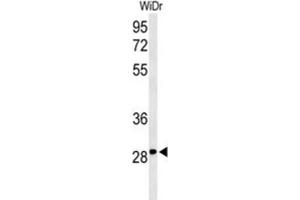 Western Blotting (WB) image for anti-Nicotinamide Riboside Kinase 1 (NMRK1) antibody (ABIN3004262) (NMRK1 抗体)