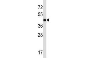 ACTG2 antibody western blot analysis in CEM lysate (ACTG2 抗体  (AA 343-371))