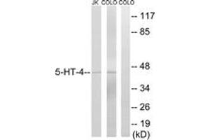 Western Blotting (WB) image for anti-Serotonin Receptor 4 (HTR4) (AA 21-70) antibody (ABIN2889848) (Serotonin Receptor 4 抗体  (AA 21-70))