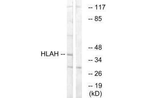 Western blot analysis of extracts from LOVO cells, using HLAH antibody. (HLA-H 抗体)