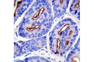 PSMA antibody immunohistochemistry analysis in formalin fixed and paraffin embedded human prostate carcinoma. (PSMA 抗体  (AA 161-190))