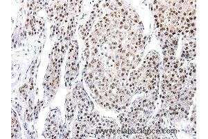 Immunohistochemistry of Human tonsil  using AQP2 Polyclonal Antibody at dilution of 1:100 (AQP2 抗体)