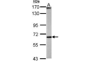 WB Image Sample (50 ug of whole cell lysate) A: mouse liver 7. (CROT 抗体)