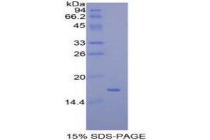 SDS-PAGE (SDS) image for Mucosae Associated Epithelia Chemokine (AA 17-130) protein (His tag) (ABIN2125973)