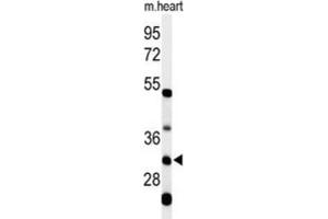 Western Blotting (WB) image for anti-Holocytochrome C Synthase (HCCS) antibody (ABIN3004361) (HCCS 抗体)