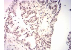 Immunohistochemistry (IHC) image for anti-BRCA1 Interacting Protein C-terminal Helicase 1 (BRIP1) (AA 904-986) antibody (ABIN7193527)