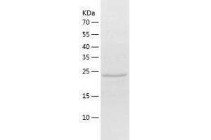 Western Blotting (WB) image for Stathmin-Like 4 (STMN4) (AA 1-216) protein (His tag) (ABIN7125213) (STMN4 Protein (AA 1-216) (His tag))