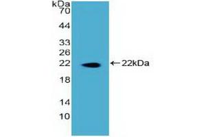 Detection of Recombinant DKC, Human using Polyclonal Antibody to Dyskerin (DKC) (DKC1 抗体)