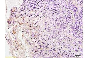 Immunohistochemistry (Paraffin-embedded Sections) (IHC (p)) image for anti-Platelet Derived Growth Factor Receptor beta (PDGFRB) (AA 981-1066) antibody (ABIN726635)
